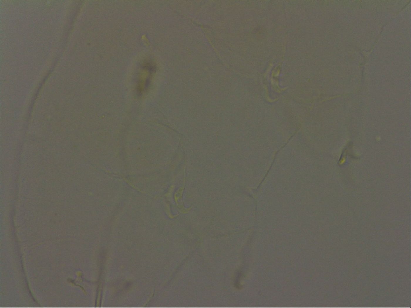 Pilatobius oculatus image