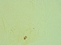 Pilatobius iltisi image