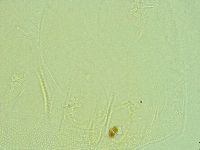 Pilatobius iltisi image