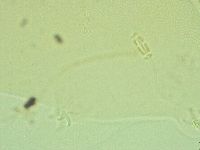 Pilatobius iltisi image