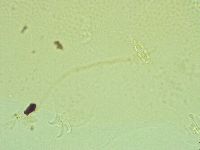 Pilatobius iltisi image