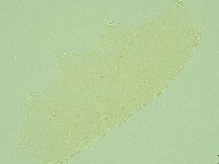 Pilatobius iltisi image