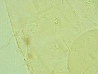 Pilatobius iltisi image