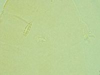 Pilatobius iltisi image