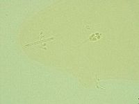Pilatobius oculatus image