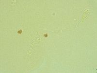 Pilatobius iltisi image