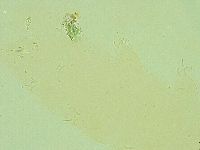 Pilatobius iltisi image