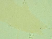 Pilatobius iltisi image