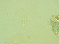 Pilatobius iltisi image