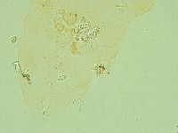 Pilatobius iltisi image