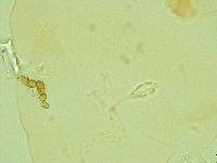 Pilatobius iltisi image