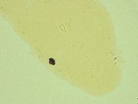 Pilatobius oculatus image
