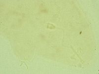 Pilatobius oculatus image