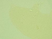 Pilatobius oculatus image
