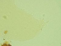 Pilatobius oculatus image