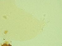 Pilatobius oculatus image