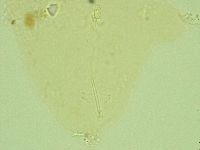 Pilatobius oculatus image