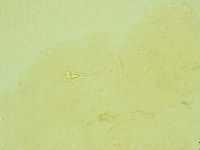 Pilatobius oculatus image