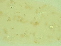 Pilatobius oculatus image