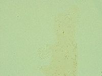 Pilatobius oculatus image