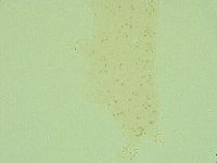 Pilatobius oculatus image