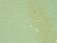 Pilatobius oculatus image