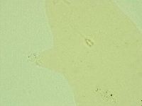 Pilatobius oculatus image