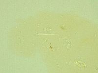 Pilatobius oculatus image