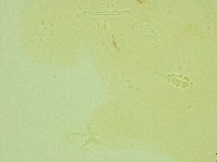 Pilatobius oculatus image