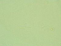 Pilatobius oculatus image