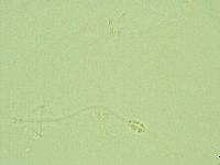 Pilatobius oculatus image