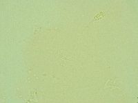 Pilatobius oculatus image