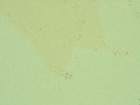 Pilatobius oculatus image