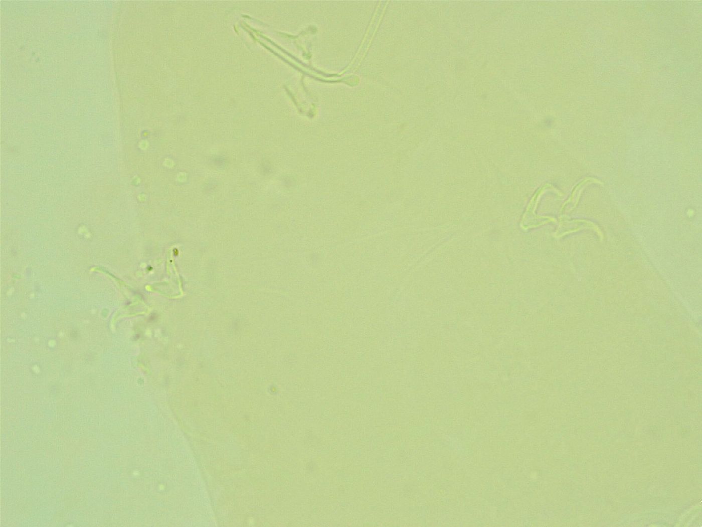 Pilatobius oculatus image