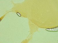Pilatobius oculatus image