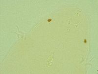 Pilatobius oculatus image
