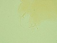 Pilatobius oculatus image