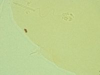Pilatobius oculatus image