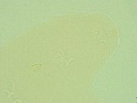 Pilatobius oculatus image