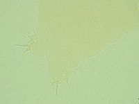 Pilatobius oculatus image