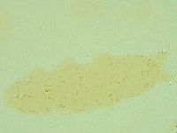 Pilatobius oculatus image