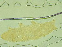 Pilatobius oculatus image