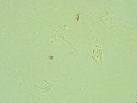 Pilatobius oculatus image