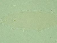 Pilatobius oculatus image