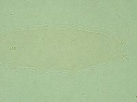 Pilatobius oculatus image