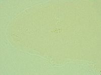Pilatobius oculatus image