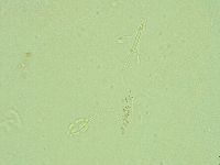Pilatobius oculatus image