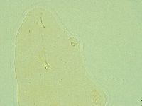 Pilatobius oculatus image