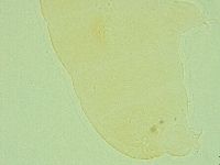 Pilatobius oculatus image