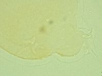 Pilatobius oculatus image